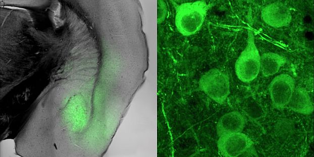 Neurons in the Amygdala, image: Friedrich Miescher Institute for Biomedical Research