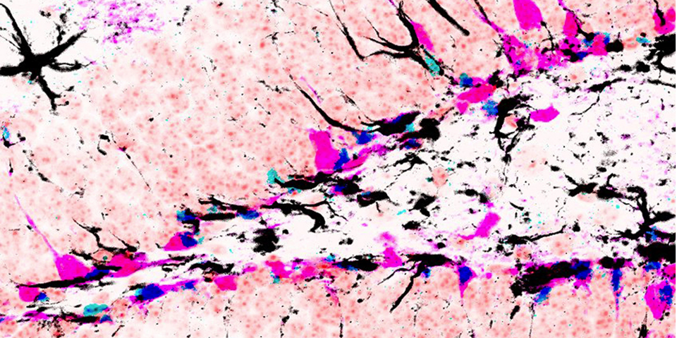 The image depicts Id4 (blue) and GFAP (black) expression in genetically labeled stem cells and their progeny (magenta) in the hippocampus of the mouse brain. The image presents an artistic coloration of the spatial and molecular factors in a niche. (Image: University of Basel)