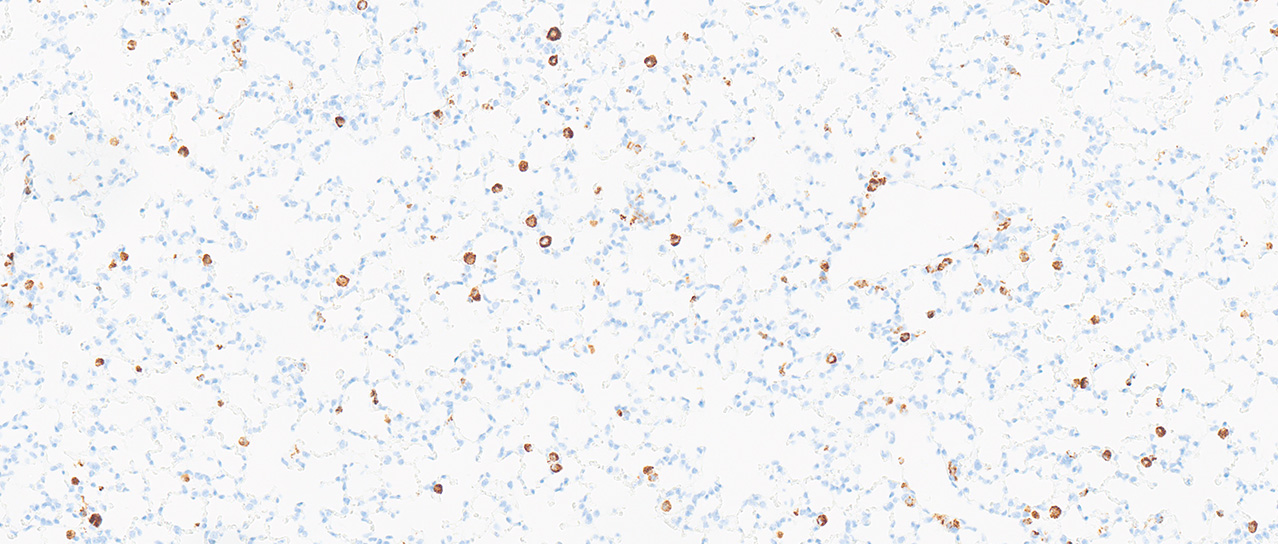 Flow Cytometry 